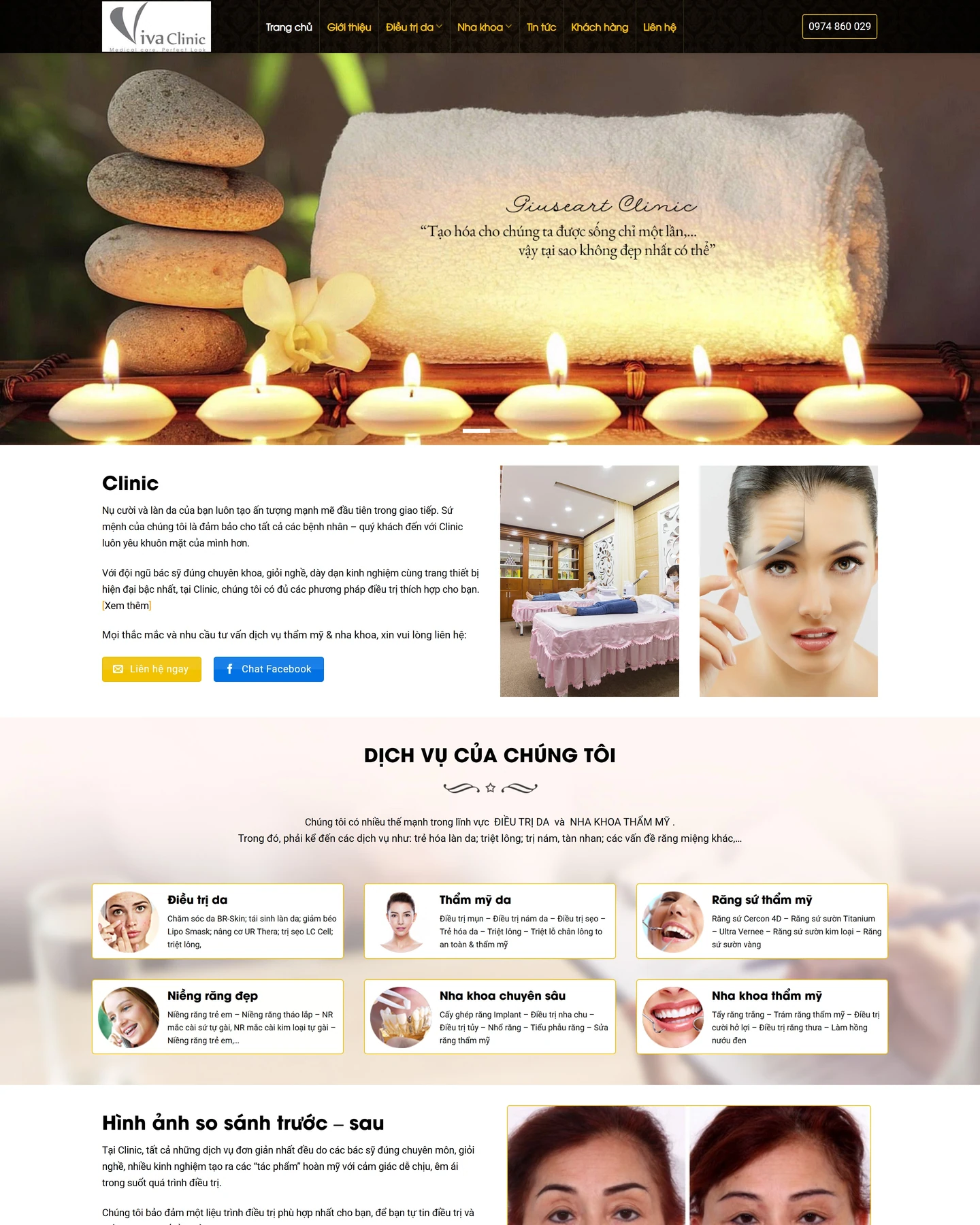 Mẫu website Vivaclinic cho lĩnh vực Mỹ phẩm & Làm đẹp