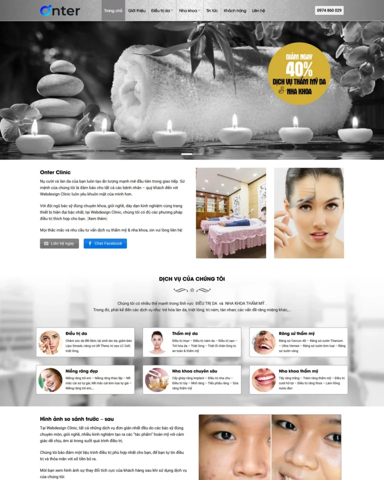 Mẫu website Thẩm mỹ viện