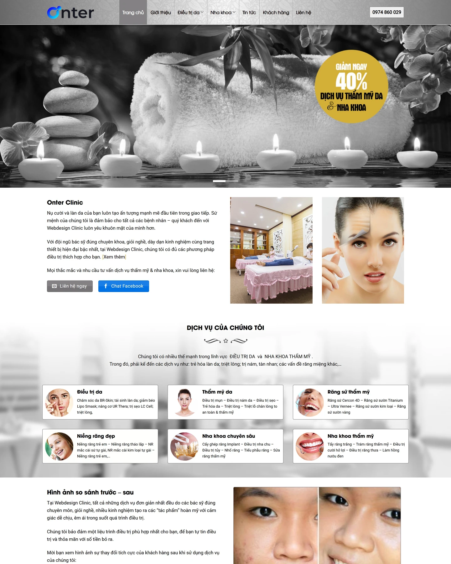 Mẫu website Thẩm mỹ viện cho lĩnh vực Mỹ phẩm & Làm đẹp